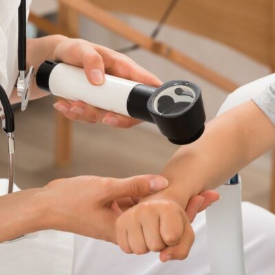 Causes and risk factors of psoriasis