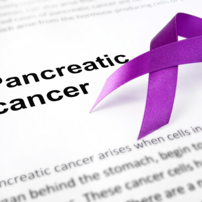 Life after treatment of pancreatic cancer