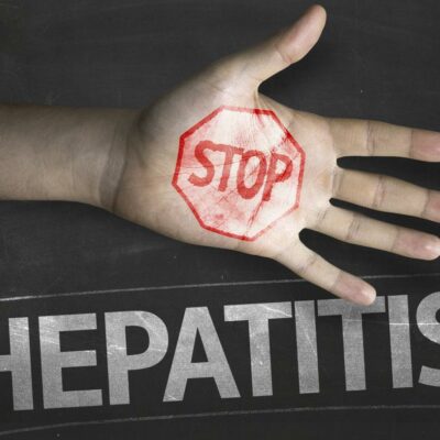 Signs and Symptoms of Hepatitis C