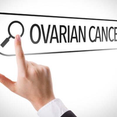 Treatment Options for Ovarian Cancer
