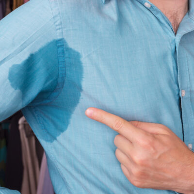 Treatments for Hyperhidrosis
