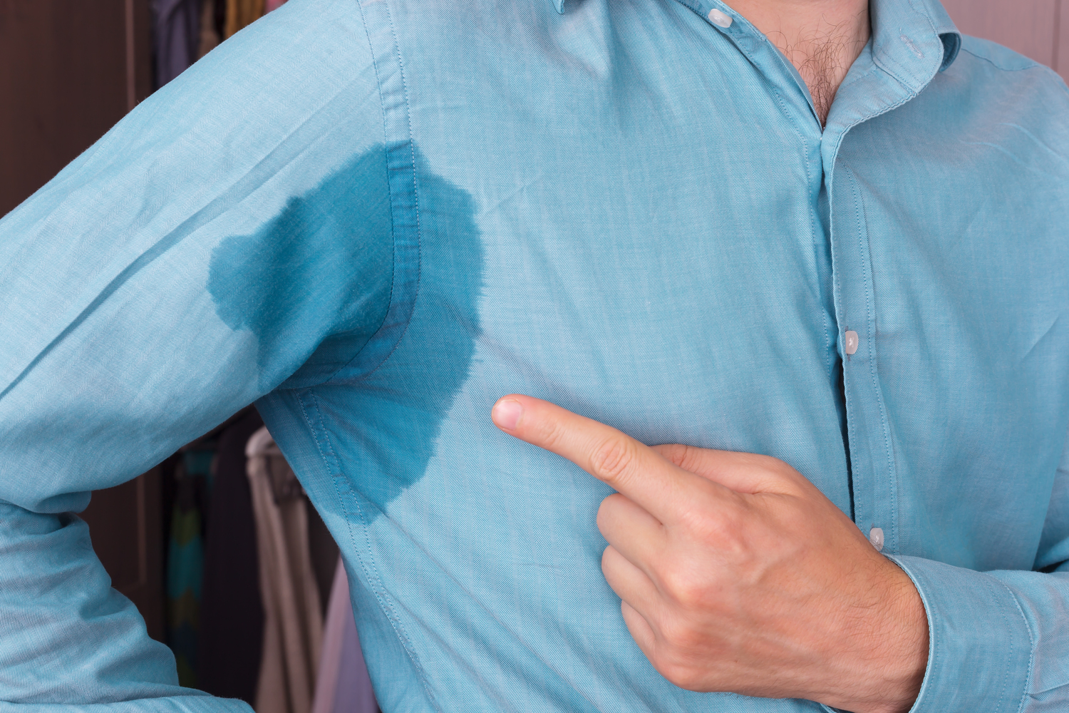 Treatments for Hyperhidrosis